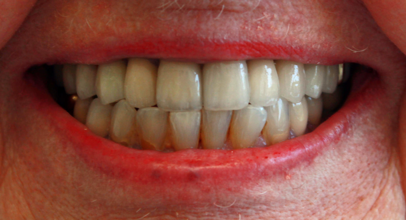 A Biting Chance dentistry that lasts quality that