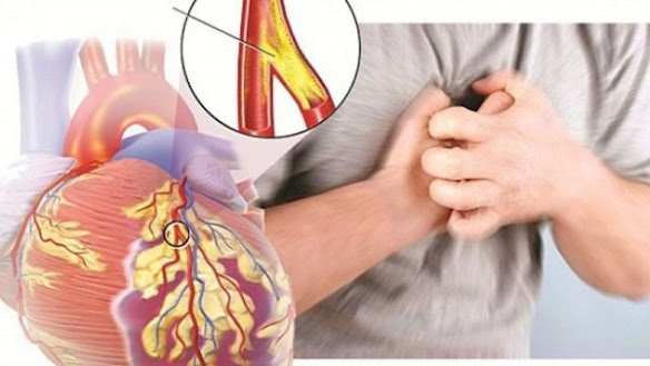 Tinnitus pulsating - Cause and remedy Causes Tinnitus pulse type