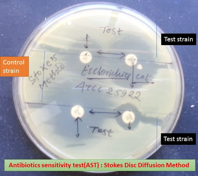 Antibiotic Susceptibility Testing Disc Diffusion & Dilution Methods