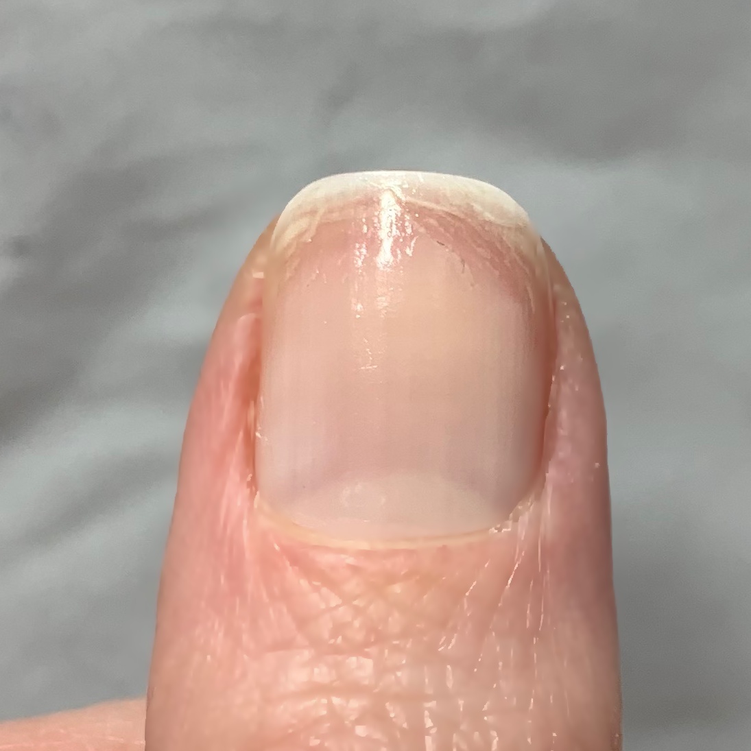 Never Enough Nails Zoya Naked Manicure Rescue + Repair Kit Review