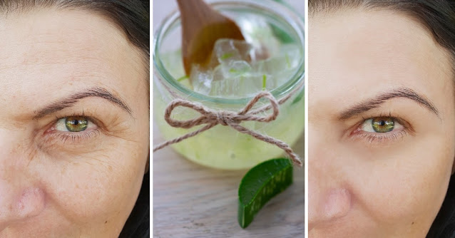 3 masques à l'aloe vera pour rajeunir la peau si vous avez déjà des rides ou des taches