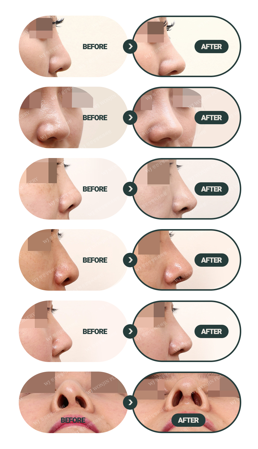 прямой нос у женщин. выбери форму носа. формы носа. формы носа картинки. форма носа и характер тест.