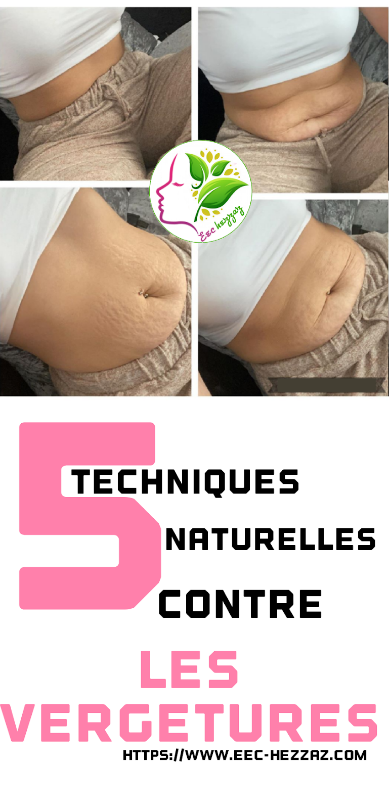 5 techniques naturelles contre les vergetures