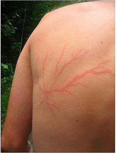 Sevasblog : things I like: Lightning Scars