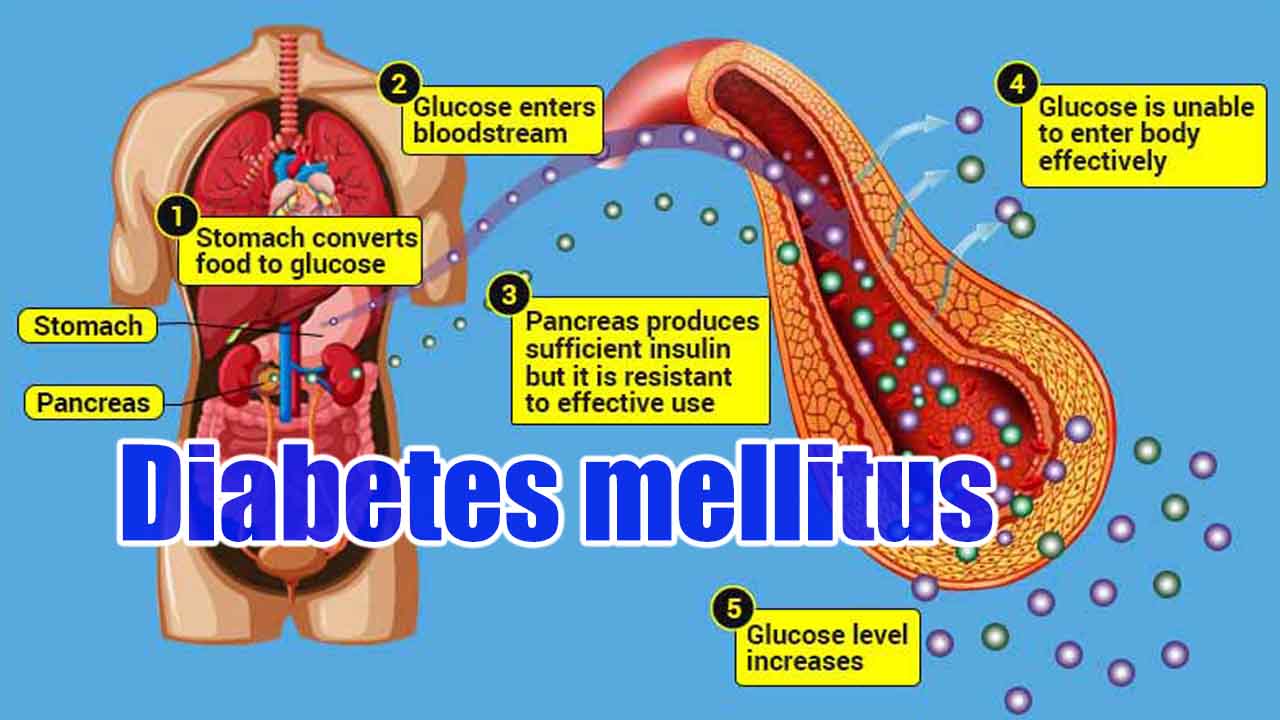 diabetes mellitus jelentése