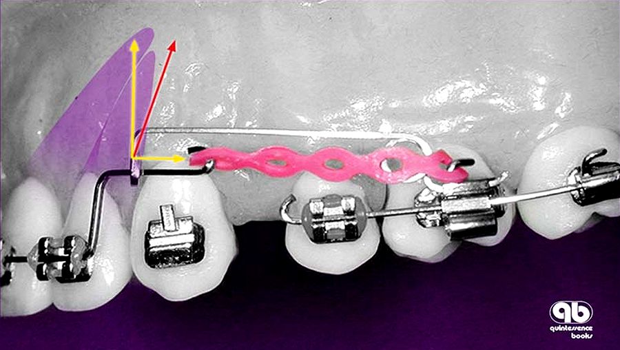 ORTHODONTICS BOOK The Biomechanical Foundation of Clinical