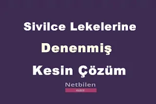 sivilcelere kesin çözüm