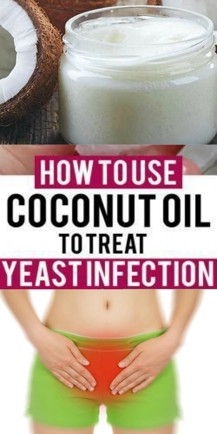 How To Use Coconut Oil For Yeast Infection? Wellness True
