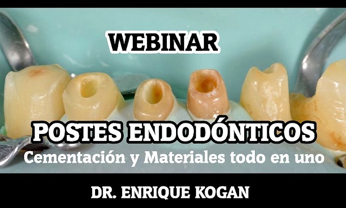 ENDOPOSTES: Cementación de postes endodónticos, materiales todo en uno - Dr. Enrique Kogan