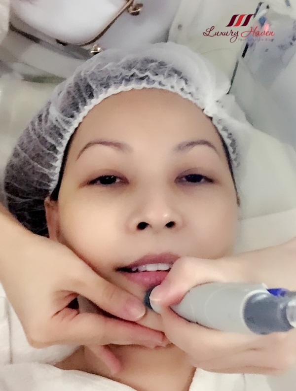 Hydrafacial deals
