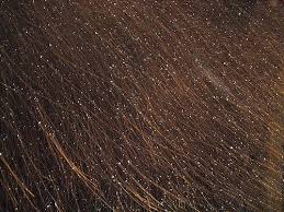 Hair problems Dry hair