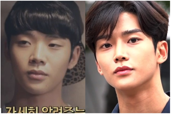 SF9 Rowoon before getting plastic surgery? 