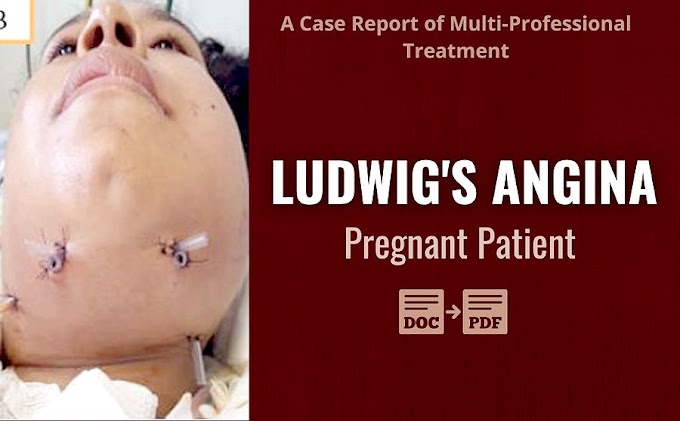 PDF: Ludwig's Angina in Pregnant Patient - A Case Report of Multi-Professional Treatment