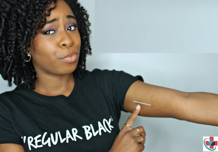 Nexplanon A new method of birth control in your arm!