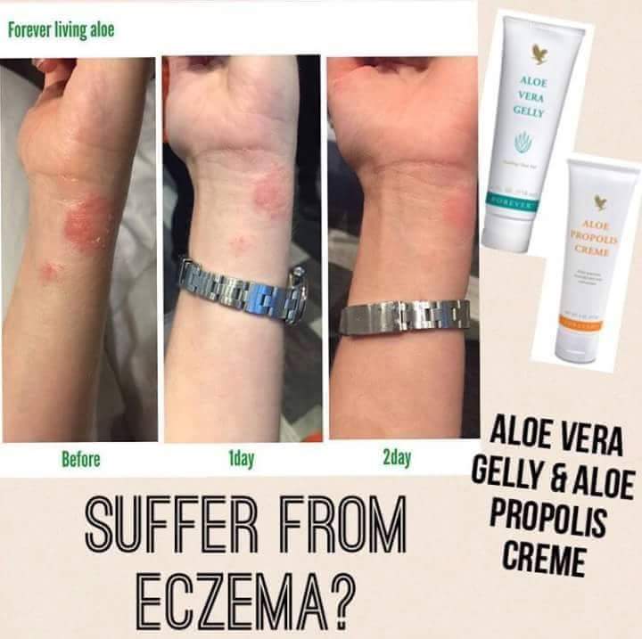 FOREVER LIVING DUNGUN ALOE VERA GELLY + ALOE PROPOLIS CREME FOREVER LIVING DUNGUN ALOE VERA GELLY + ALOE PROPOLIS CREME