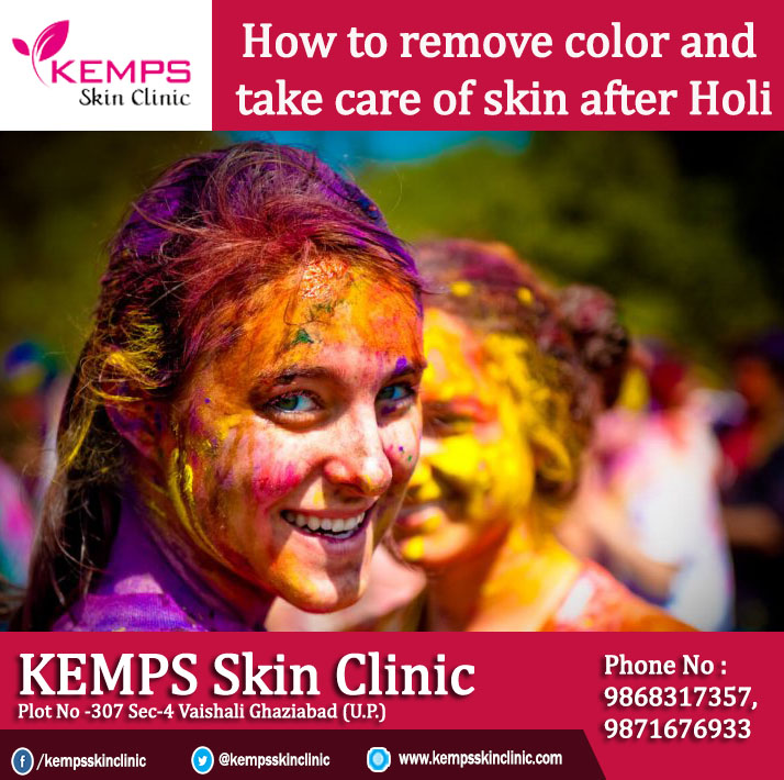 How to remove color and take care of skin after Holi KEMPS Skin Cli