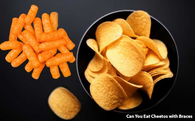 Can You Eat Cheetos With Braces And Hot Cheetos Invisalign Support