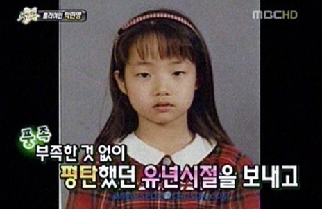 Before And After Plastic Surgery Kdrama Star Park Min Young
