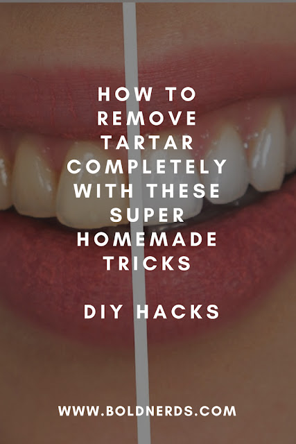 How to Remove Tartar Completely with These Super Homemade Tricks - DIY How to Remove Tartar Completely with These Super Homemade Tricks - DIY