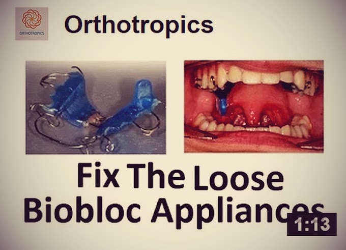 INTERVIEW: What Should Be Done About Losse, Broken or Uncomfortable Orthotropics Appliances - Prof John Mew