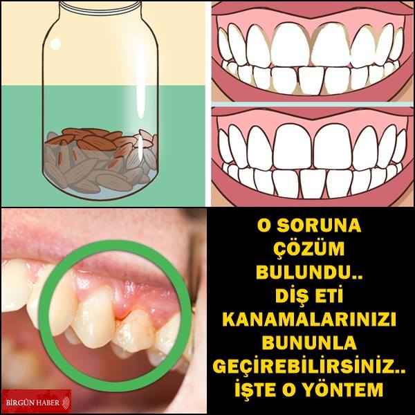 O SORUNA ÇÖZÜM BULUNDU.. DİŞ ETİ KANAMALARINIZI BUNUNLA