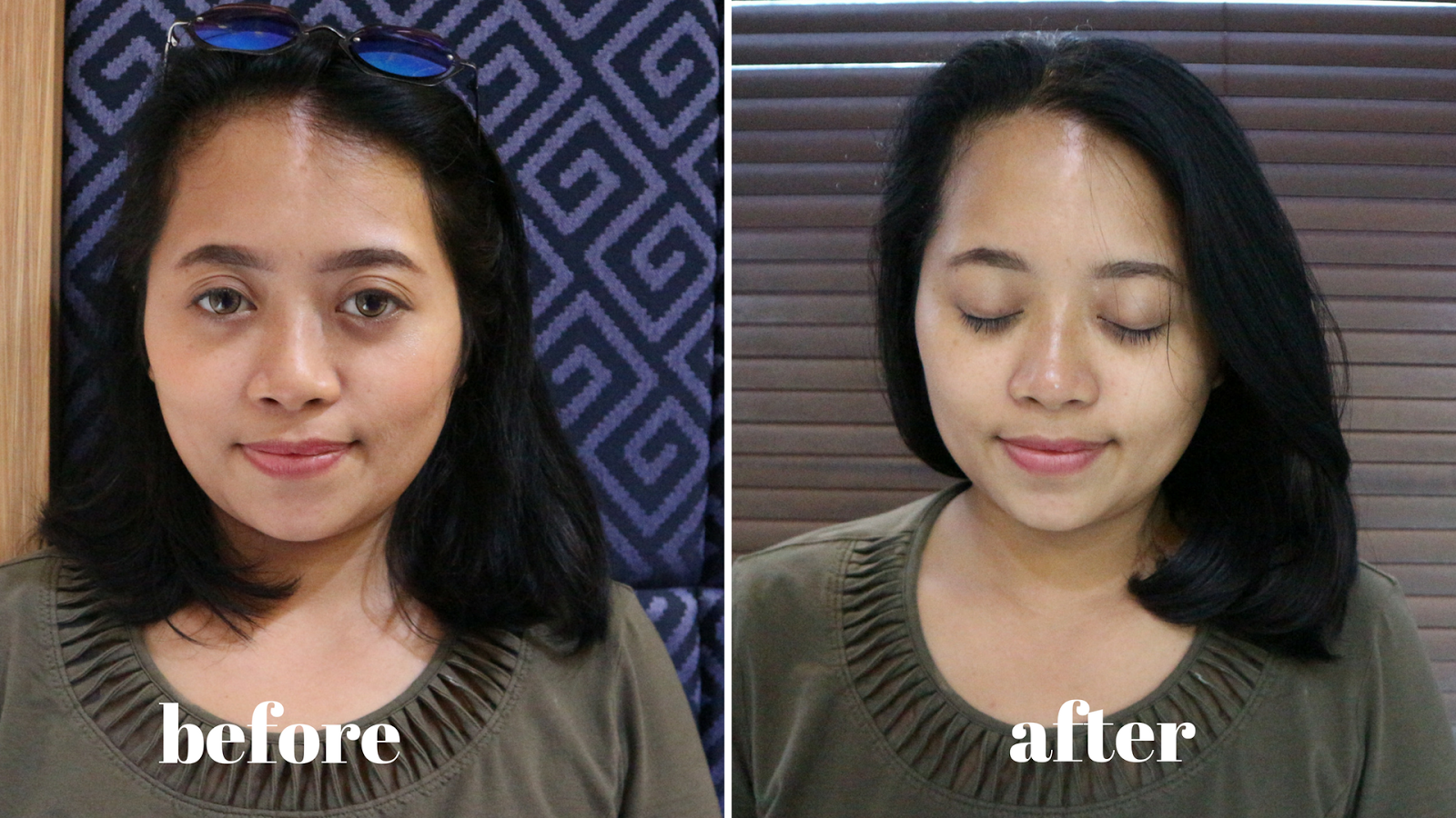 Bali Beauty Blogger Whitening Facial Microdermabrasi Klinik Estetika Dr Affandi