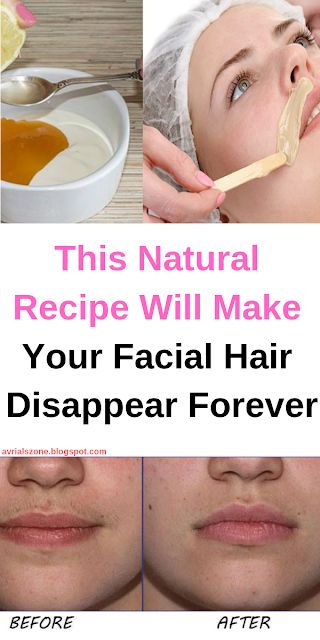 This Natural Recipe Will Make Your Facial Hair Disappear ForeverMake ...