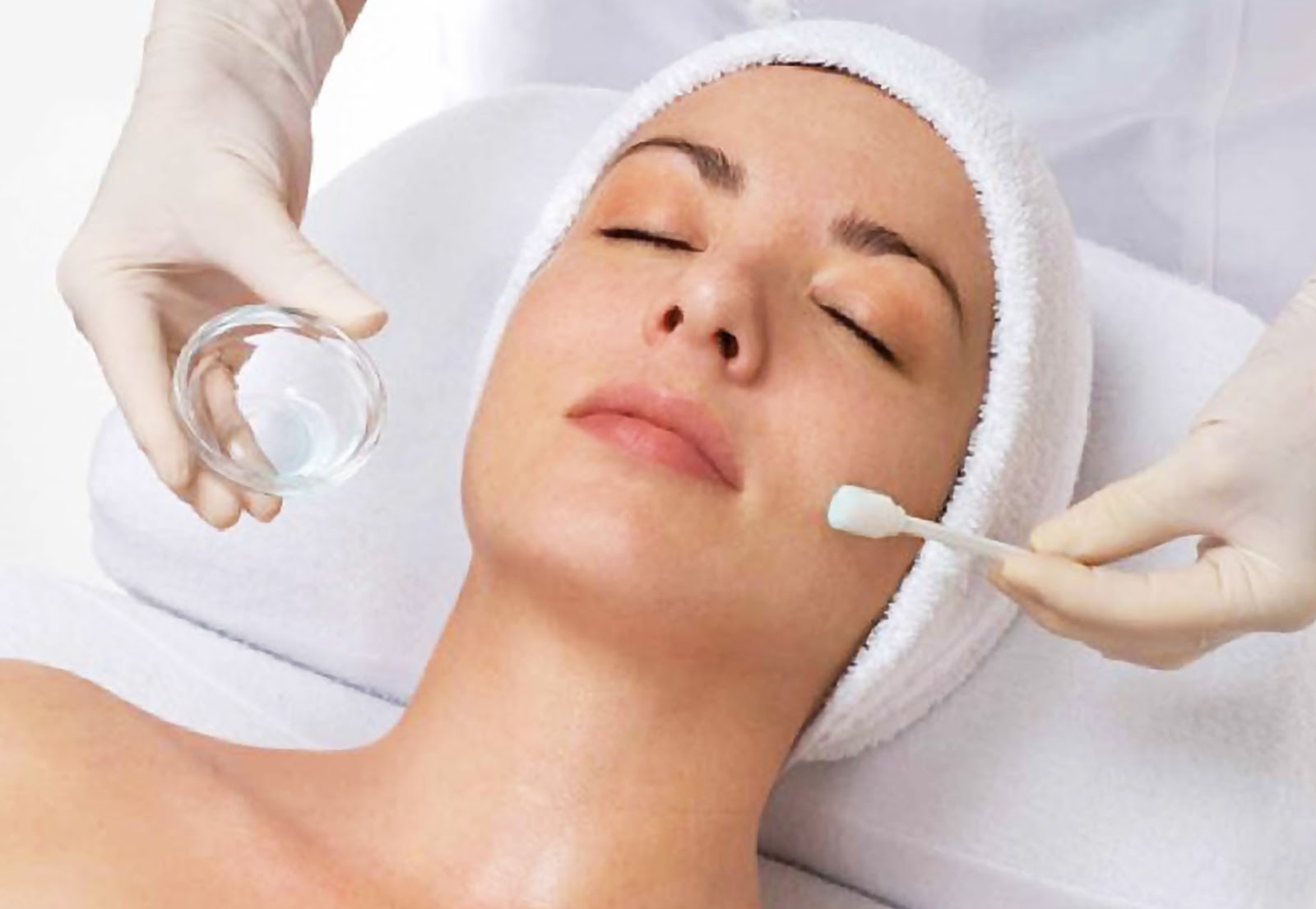 Chemical Peeling And Its Benefits Kemps Skin Clinic