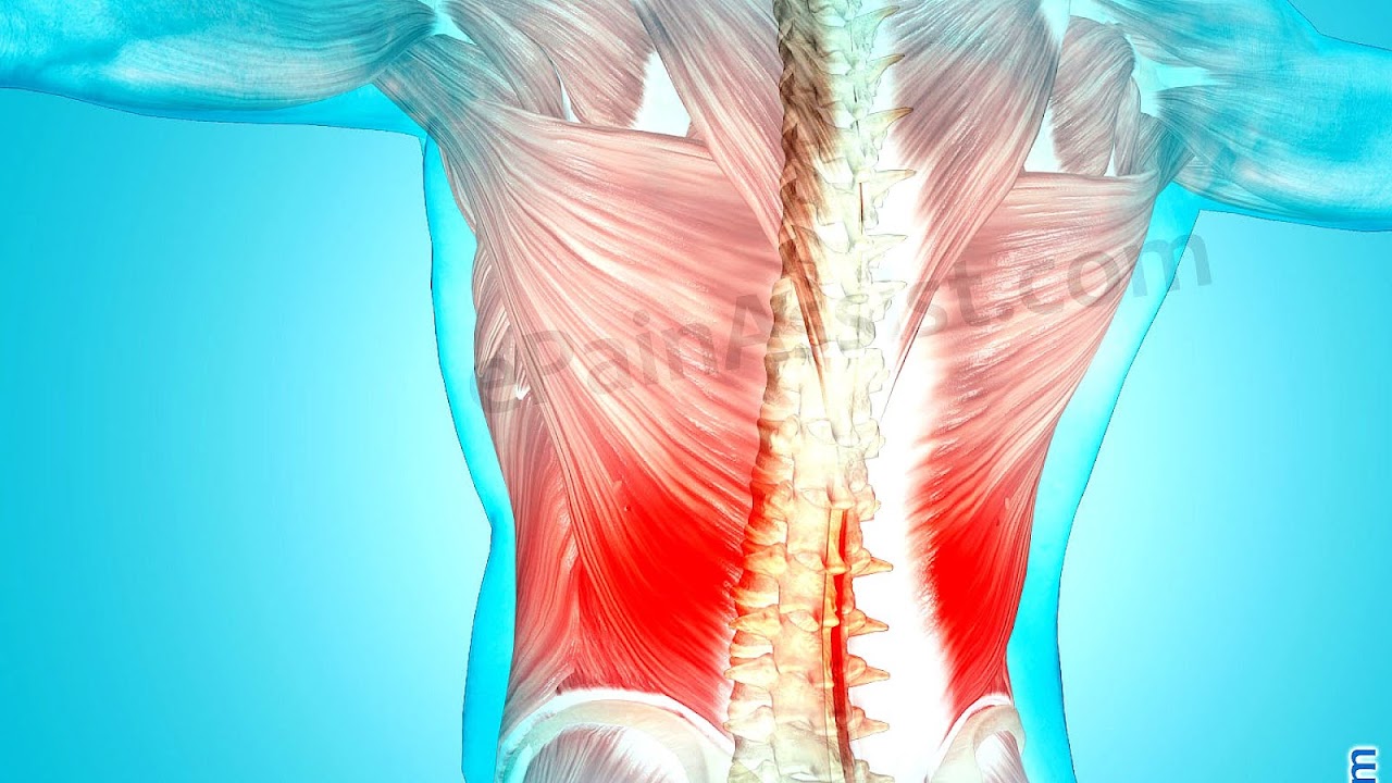 Treatment For Pulled Back Muscle Pain