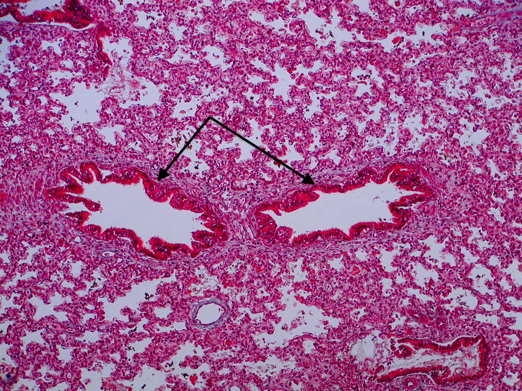 SOS BIOLOGIA CELULAR Y TISULAR: RESPIRATORIO. PULMON