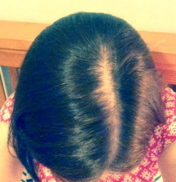 Fights Like A Girl Everything I've learned about... Chemo and hair loss