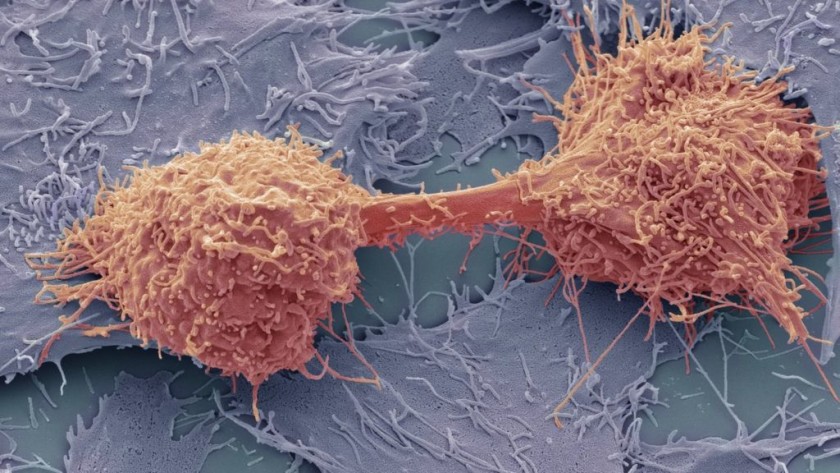 CancerSEEK - Detección Precoz De 8 Tipos De Cáncer Mediante Un Simple Análisis De Sangre