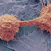 CancerSEEK : Detección Precoz De 8 Tipos De Cáncer Mediante Un Simple Análisis De Sangre