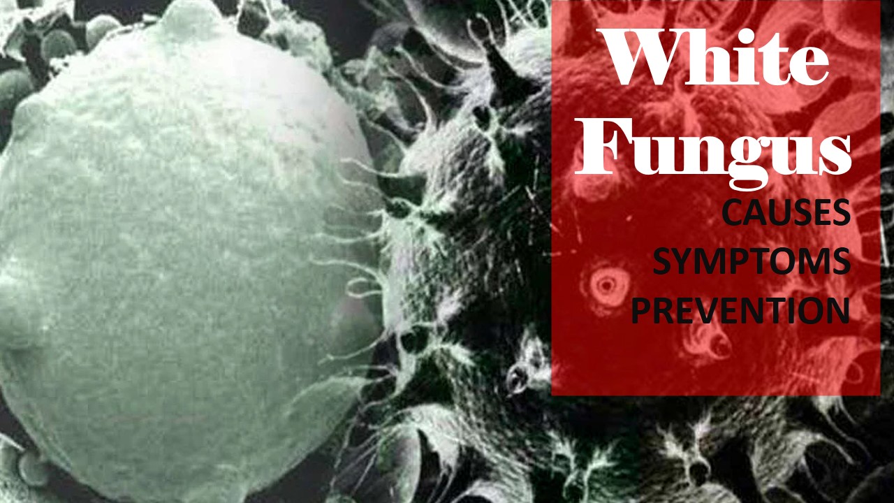 White Fungus Causes, symptoms and prevention