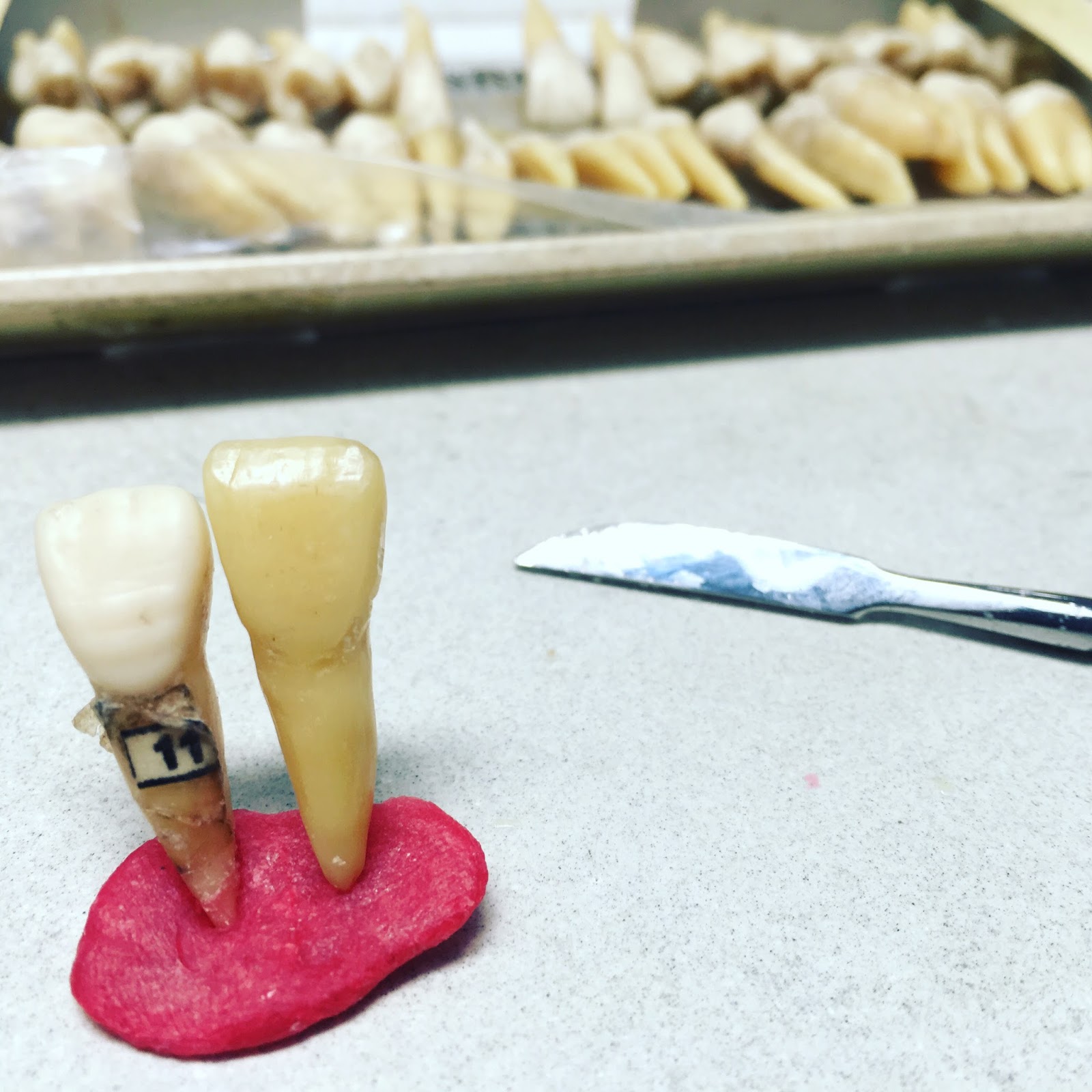 Life as a First Year Dental Student in USM