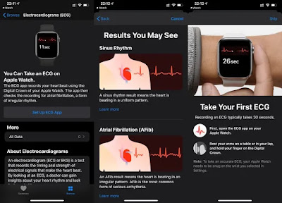 WatchOS 6 update brings ECG support for Apple Watch Apple Inc. A new update for iOS devices running iOS 13. In addition, the company also released a new update for watchOS 6
