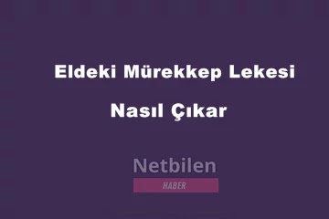 eldeki deriden murekkep lekesi nasil cikar kesin cozum netbilen haber