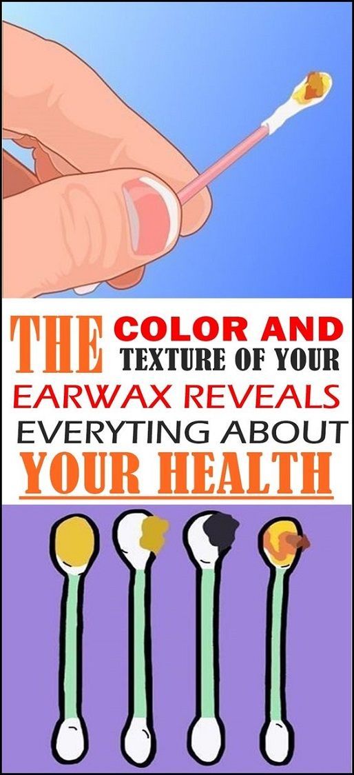 Did You Know That The Color Of Your Earwax Can Reveal How Healthy You