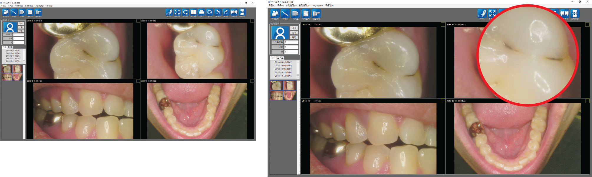 IntraOral Software Installation
