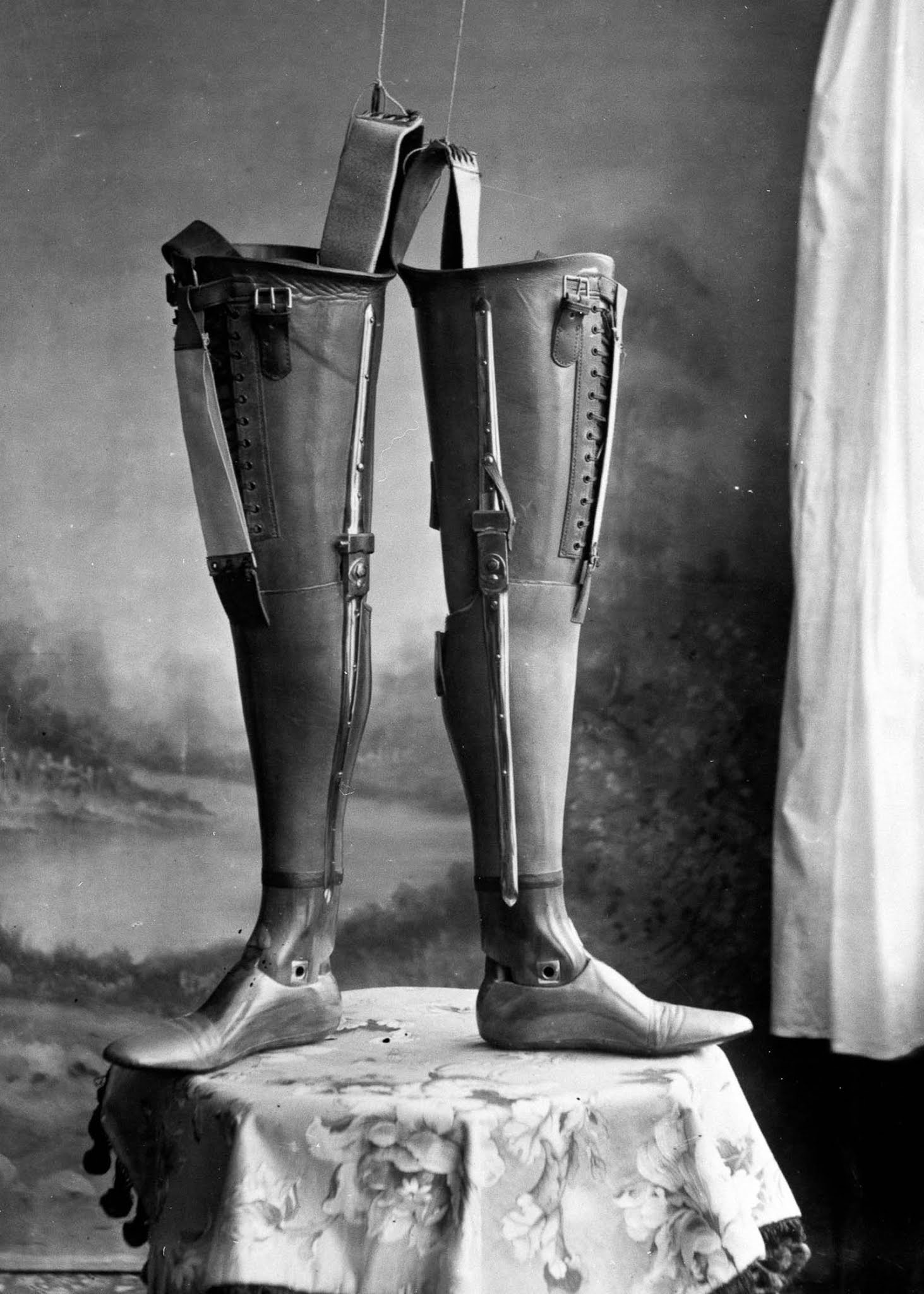 The extraordinary early prostheses made by James Gillingham  1900 - 63