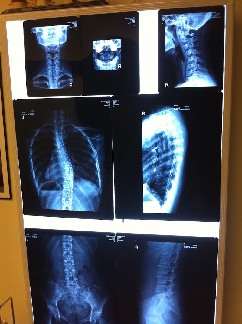 I Have A Crooked Spine