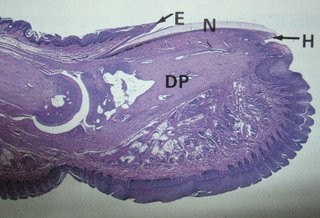 Blog Mahasiswa: Integumentum Histologi Part 4 (Rambut dan Kuku)