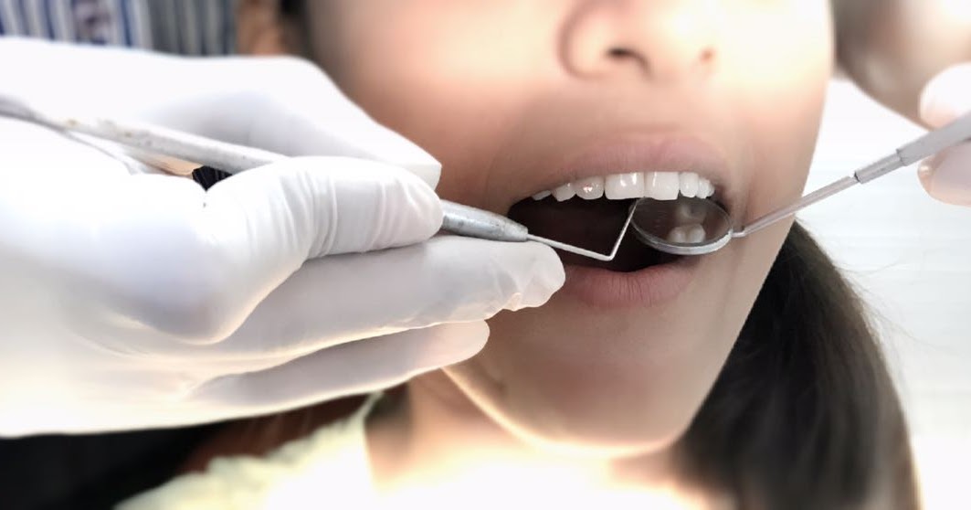 Vestibuloplasty Definition, Techniques, Procedure, Indications