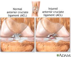 ligamentele articulare cel mai bun medicament