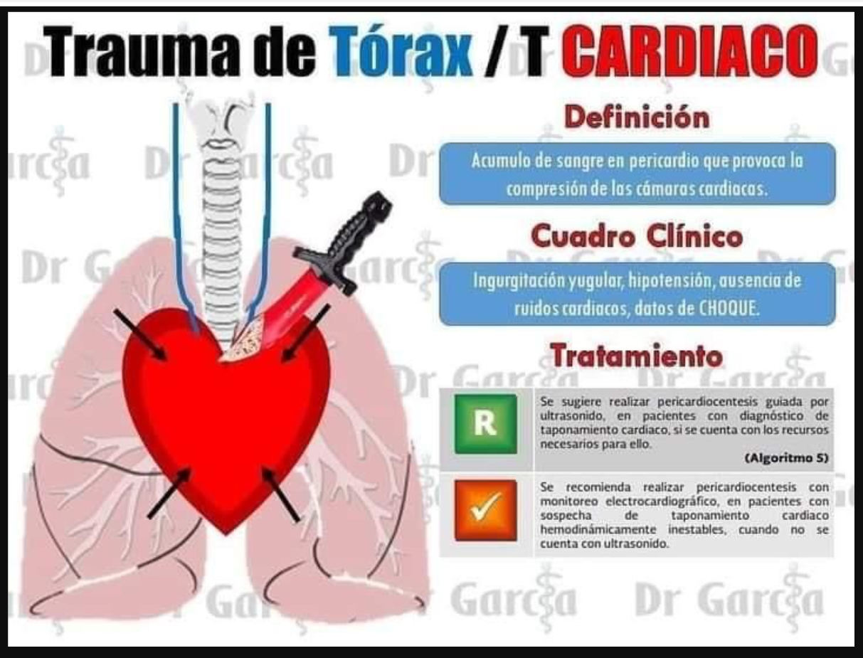 Lesiones De Torax