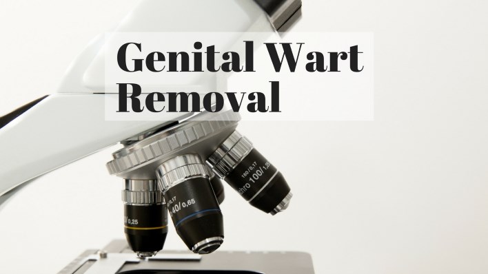 genital wart removal genital wart removal