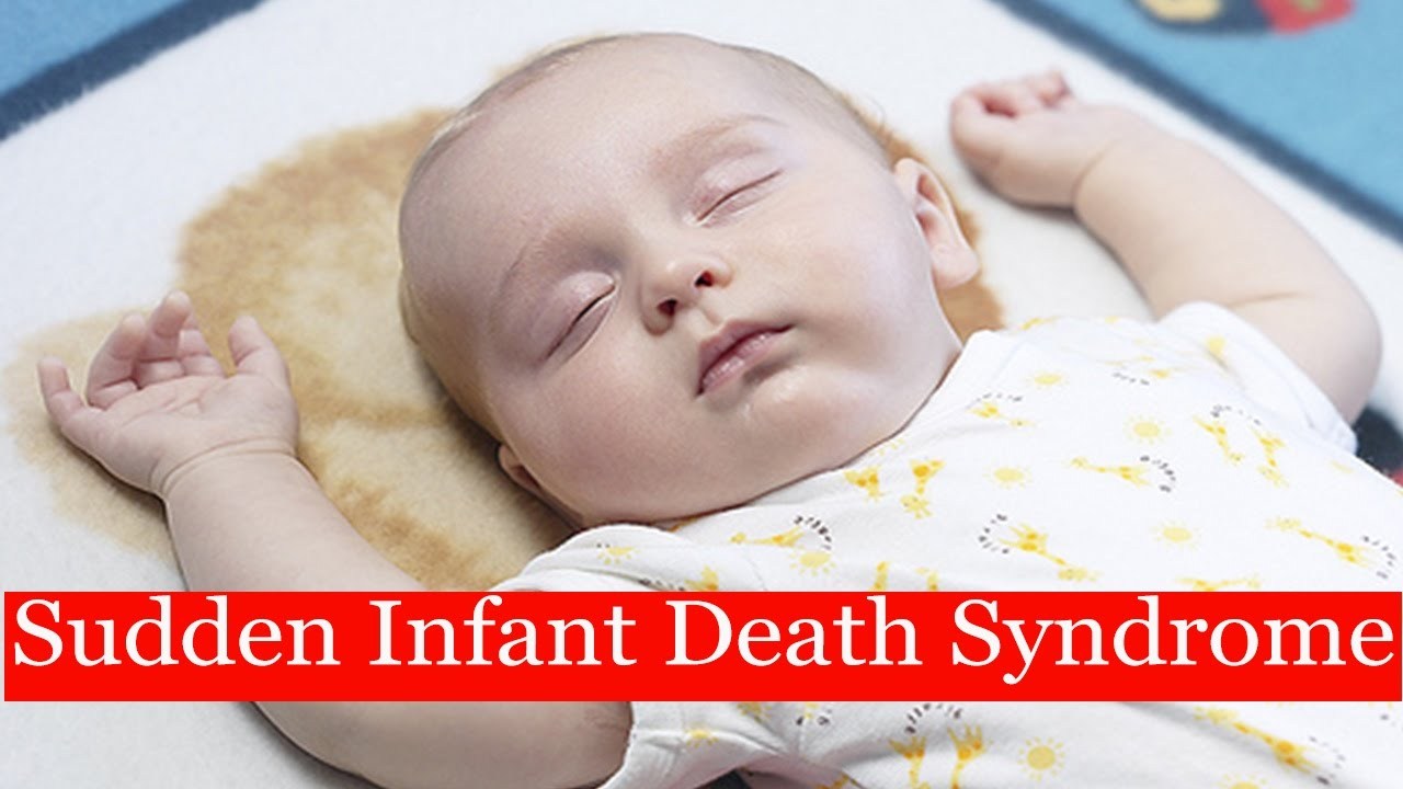 Sudden infant death syndrome
