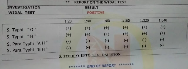 Widal test in Hindi | Widal test kya hota hai in Hindi.