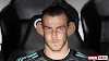 Las orejas de Bale vuelven a su posición original tras el uso continuado de la Mascarilla