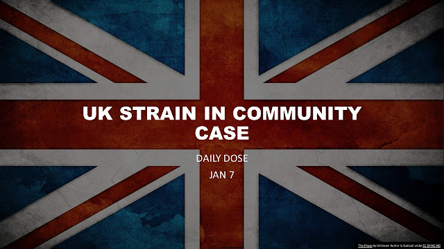 UK Strain confirmed in community case